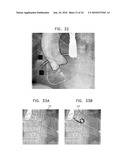 AUTOMATIC STABILIZATION OF AN IMAGE STREAM OF A MOVING ORGAN diagram and image