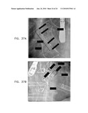 AUTOMATIC STABILIZATION OF AN IMAGE STREAM OF A MOVING ORGAN diagram and image