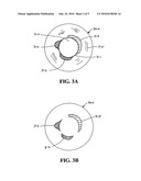 SYSTEMS AND METHODS FOR IMAGE SEGMENTATION WITH A MULTI-STAGE CLASSIFIER diagram and image
