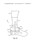 Device for Generating Power From a Locomotion Energy Associated With Leg Muscles Acting Across a Joint diagram and image