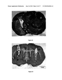 MICROSPHERES FOR TREATMENT OF BRAIN TUMORS diagram and image