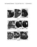 MICROSPHERES FOR TREATMENT OF BRAIN TUMORS diagram and image