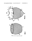 CARDIAC SUPPORT DEVICE WITH DIFFERENTIAL COMPLIANCE diagram and image