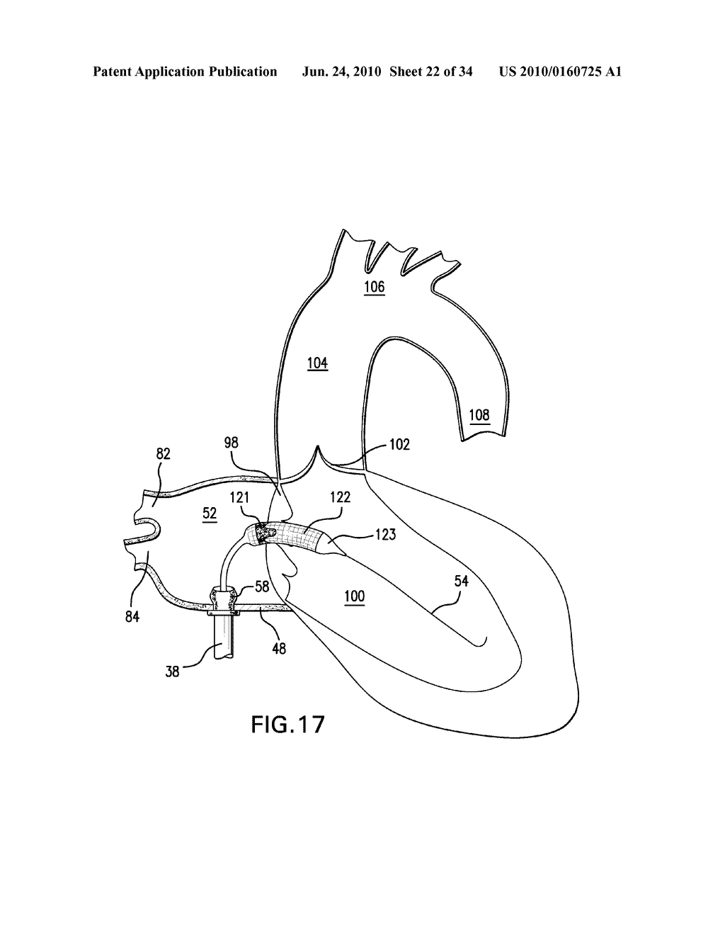 Methods and Devices for Endoscopic Access to the Heart - diagram, schematic, and image 23