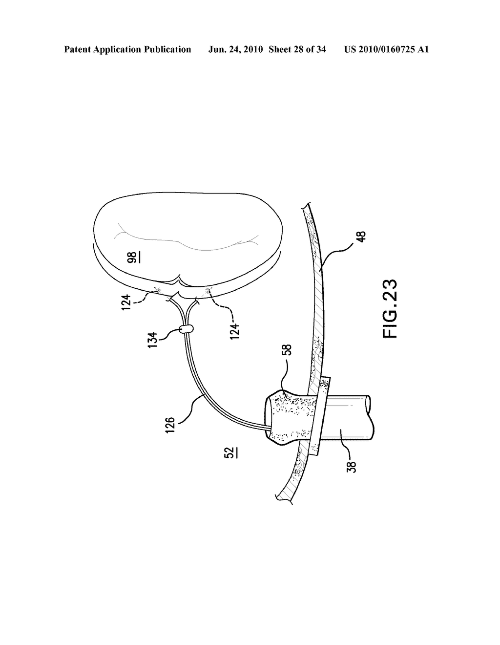 Methods and Devices for Endoscopic Access to the Heart - diagram, schematic, and image 29
