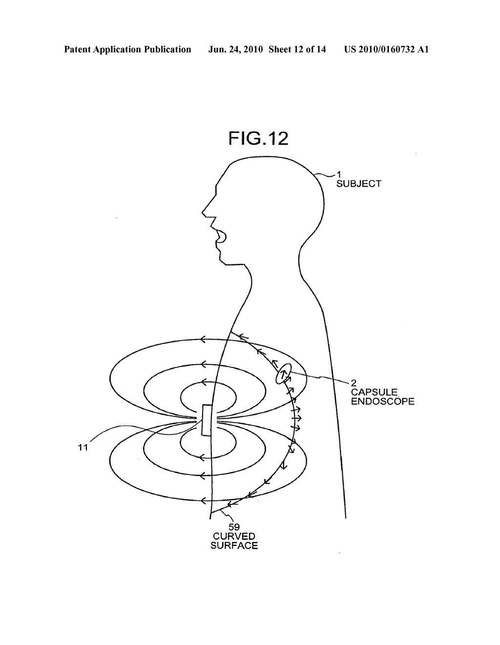 POSITION DETECTING APPARATUS, BODY-INSERTABLE APPARATUS SYSTEM, AND POSITION DETECTING METHOD - diagram, schematic, and image 13