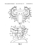 Magnetic surgical retractor diagram and image