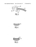 Magnetic surgical retractor diagram and image