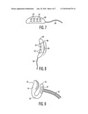 Magnetic surgical retractor diagram and image