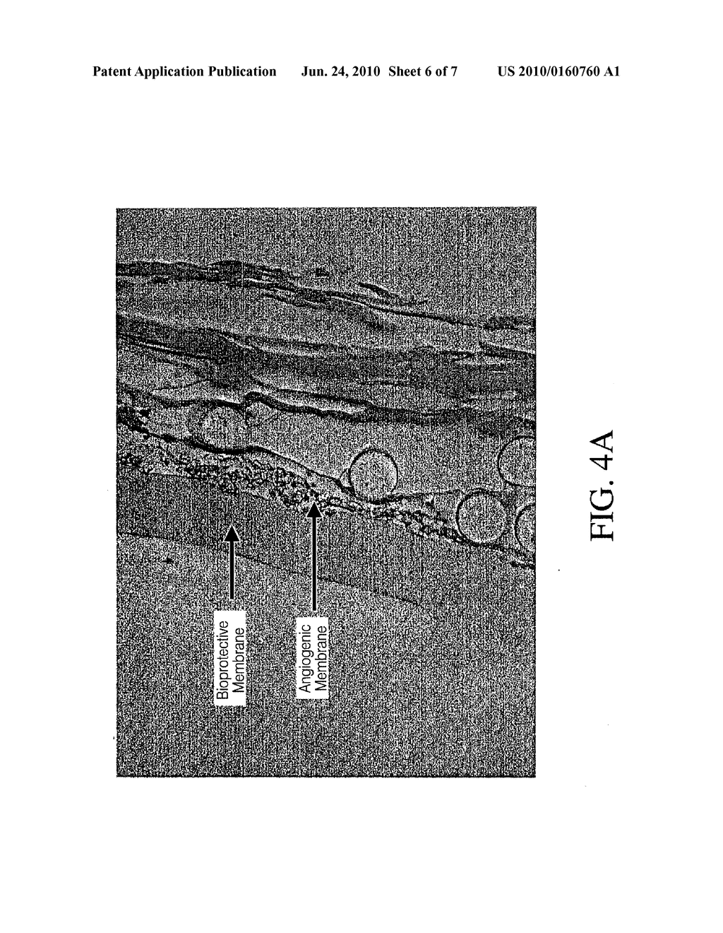 DEVICE AND METHOD FOR DETERMINING ANALYTE LEVELS - diagram, schematic, and image 07