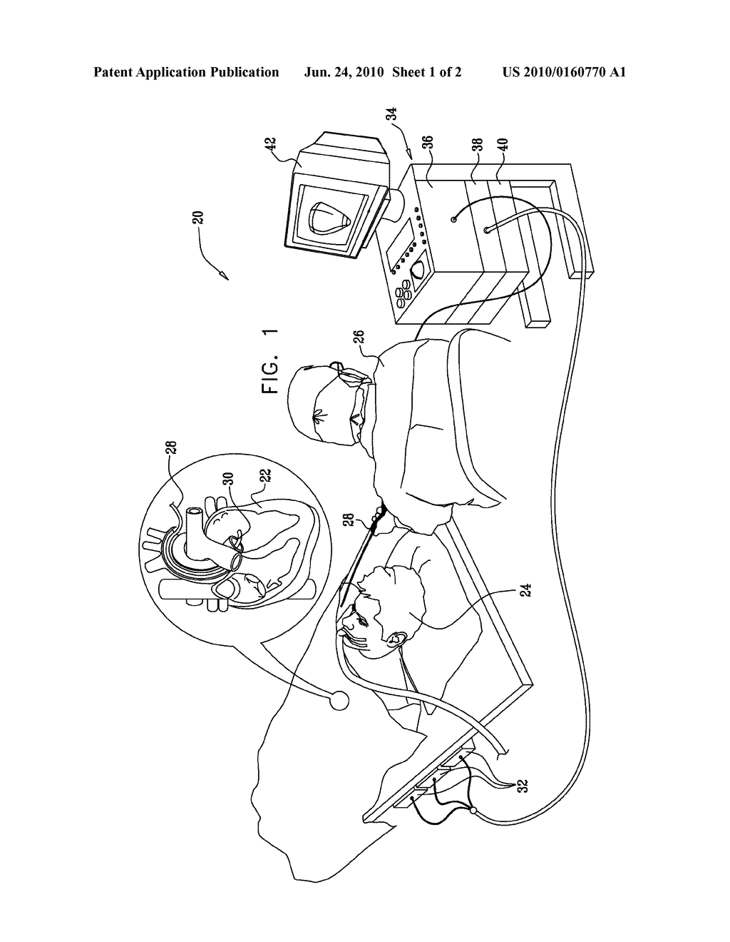 CATHETER DISPLAY SHOWING TIP ANGLE AND PRESSURE - diagram, schematic, and image 02