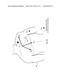 BODY-WORN SYSTEM FOR MEASURING CONTINUOUS NON-INVASIVE BLOOD PRESSURE (cNIBP) diagram and image