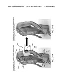 BODY-WORN SYSTEM FOR MEASURING CONTINUOUS NON-INVASIVE BLOOD PRESSURE (cNIBP) diagram and image