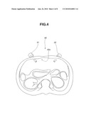 MEDICAL APPARATUS AND LIVING TISSUE FREEZING AND HARVESTING APPARATUS diagram and image