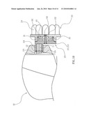 Massaging Device That Is Assembled and Disassembled Easily and Quickly diagram and image