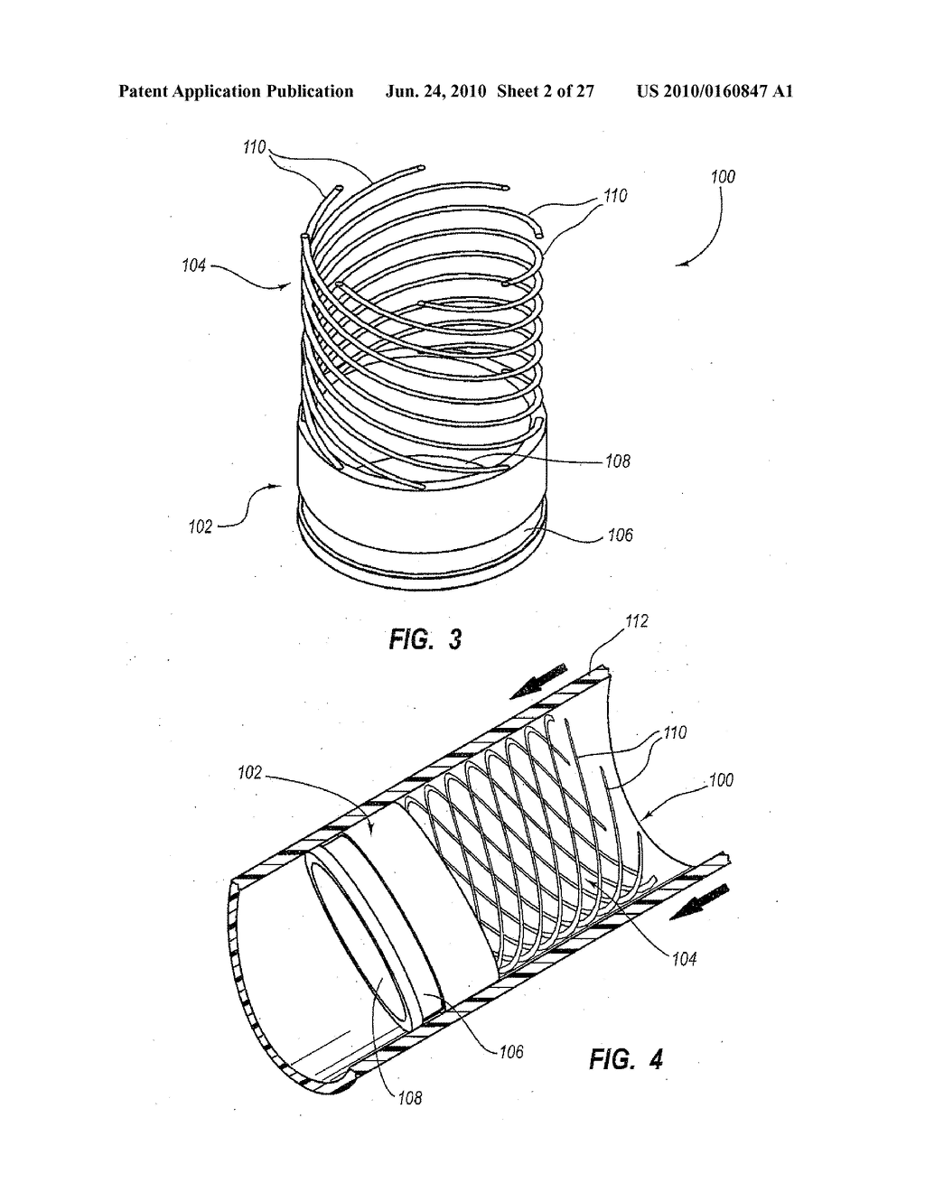 SYSTEMS, APPARATUSES, AND METHODS FOR CARDIOVASCULAR CONDUITS AND CONNECTORS - diagram, schematic, and image 03