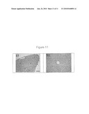 GELS WITH PREDETERMINED CONDUCTIVITY USED IN ELECTROPORATION OF TISSUE diagram and image