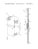 REINFORCED CLOSURE ANCHOR diagram and image