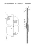 REINFORCED CLOSURE ANCHOR diagram and image