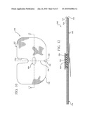 REINFORCED CLOSURE ANCHOR diagram and image