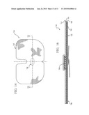 REINFORCED CLOSURE ANCHOR diagram and image