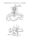 Apparatus and Method to Inject Fluids into Bone Marrow and Other Target Sites diagram and image