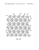 REDUCED-PRESSURE WOUND TREATMENT SYSTEMS AND METHODS EMPLOYING MICROSTRAIN-INDUCING MANIFOLDS diagram and image