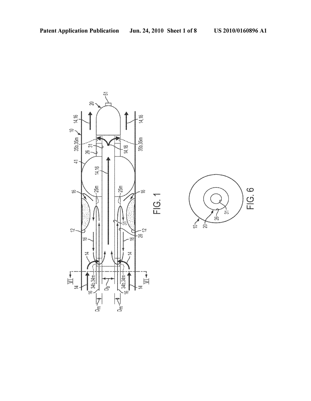 Blood Flow Bypass Catheters and Methods for the Delivery of Medium to the Vasculature and Body Ducts - diagram, schematic, and image 02