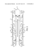 Blood Flow Bypass Catheters and Methods for the Delivery of Medium to the Vasculature and Body Ducts diagram and image