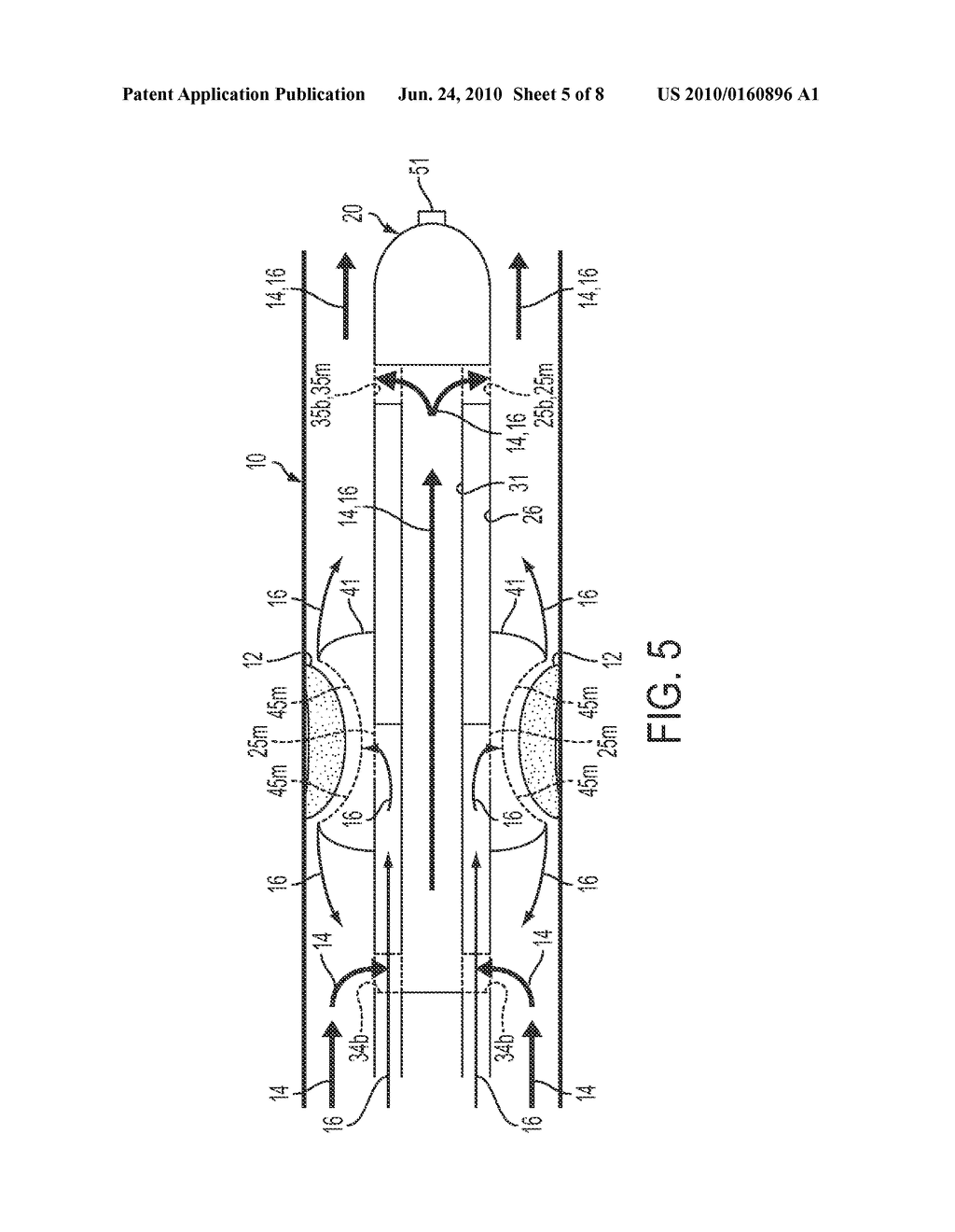 Blood Flow Bypass Catheters and Methods for the Delivery of Medium to the Vasculature and Body Ducts - diagram, schematic, and image 06