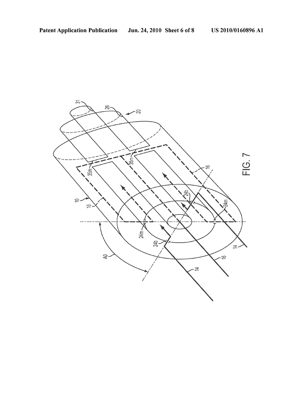 Blood Flow Bypass Catheters and Methods for the Delivery of Medium to the Vasculature and Body Ducts - diagram, schematic, and image 07