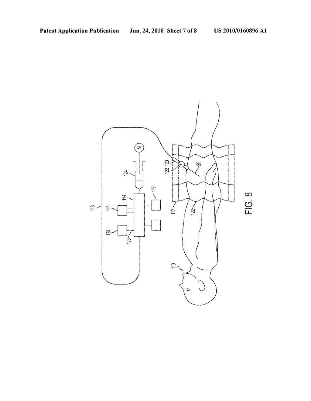 Blood Flow Bypass Catheters and Methods for the Delivery of Medium to the Vasculature and Body Ducts - diagram, schematic, and image 08