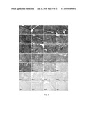 PHOTOTHERMAL TREATMENT OF SOFT TISSUES diagram and image