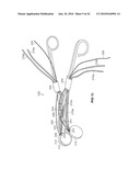 PHOTOTHERMAL TREATMENT OF SOFT TISSUES diagram and image