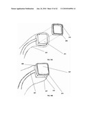 PHOTOTHERMAL TREATMENT OF SOFT TISSUES diagram and image