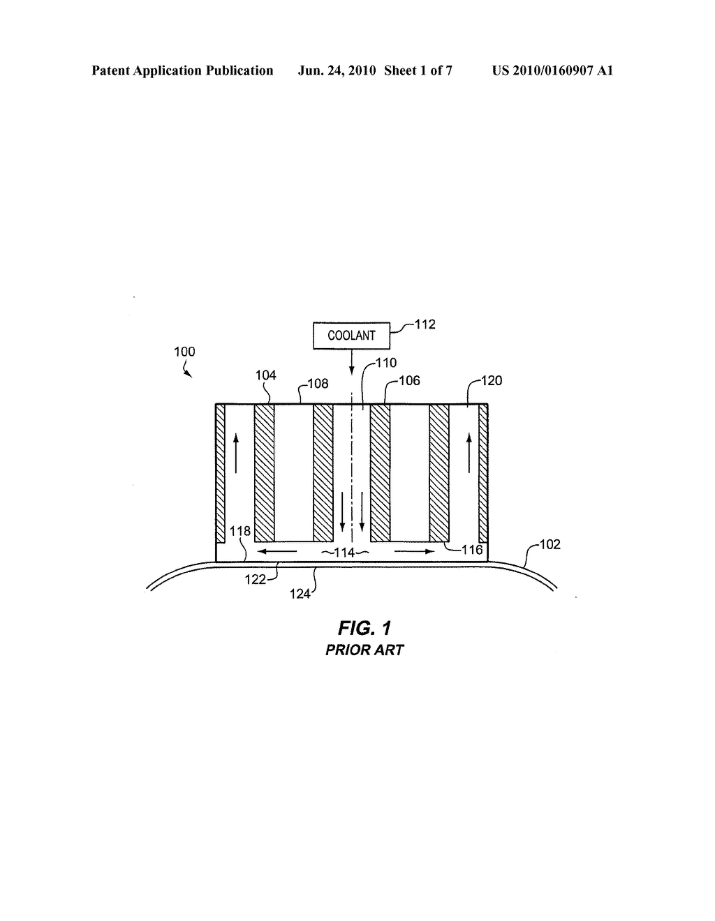 Thermokeratoplasty Systems - diagram, schematic, and image 02