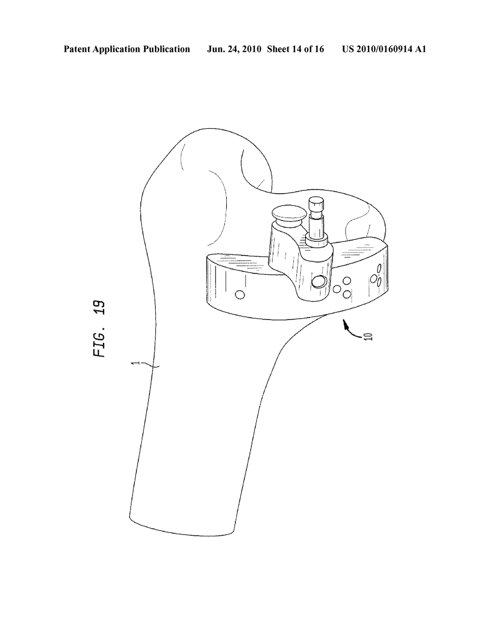 SINGLE USE RESECTION GUIDE - diagram, schematic, and image 15