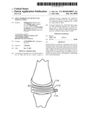 Joint Arthroplasty Devices and Surgical Tools diagram and image