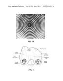 Joint Arthroplasty Devices and Surgical Tools diagram and image