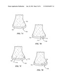 Joint Arthroplasty Devices and Surgical Tools diagram and image