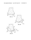 Joint Arthroplasty Devices and Surgical Tools diagram and image