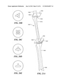 Joint Arthroplasty Devices and Surgical Tools diagram and image