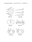 Joint Arthroplasty Devices and Surgical Tools diagram and image