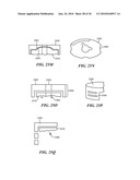 Joint Arthroplasty Devices and Surgical Tools diagram and image