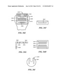 Joint Arthroplasty Devices and Surgical Tools diagram and image