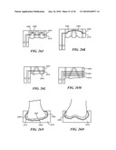 Joint Arthroplasty Devices and Surgical Tools diagram and image