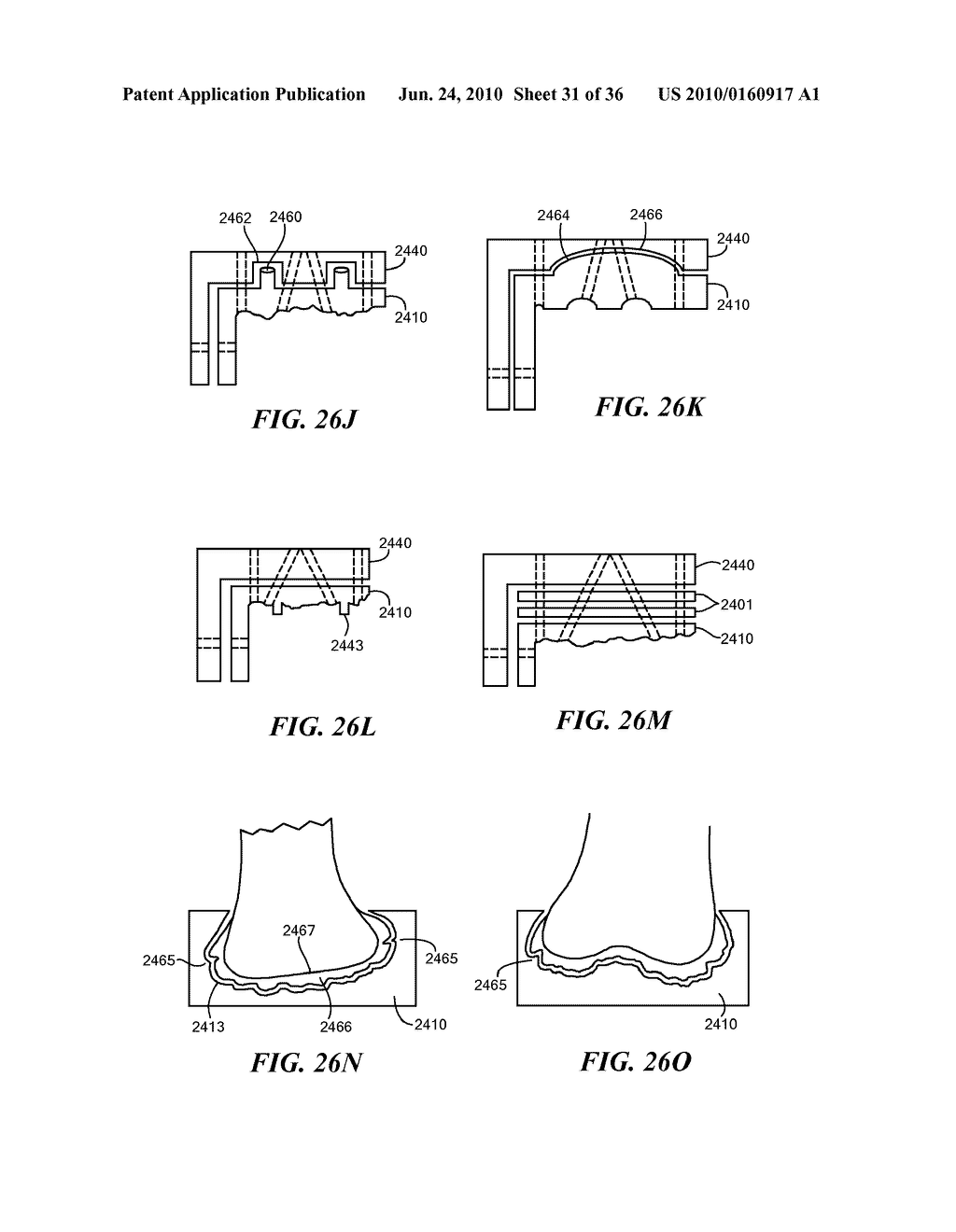 Joint Arthroplasty Devices and Surgical Tools - diagram, schematic, and image 32