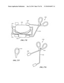 Joint Arthroplasty Devices and Surgical Tools diagram and image