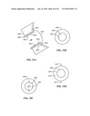 Joint Arthroplasty Devices and Surgical Tools diagram and image