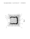 TWO-PART BONE CEMENT COMPOSITE CONTAINING PARTICLES IN A NON-UNIFORM SPATIAL DISTRIBUTION AND DEVICES FOR IMPLEMENTATION diagram and image